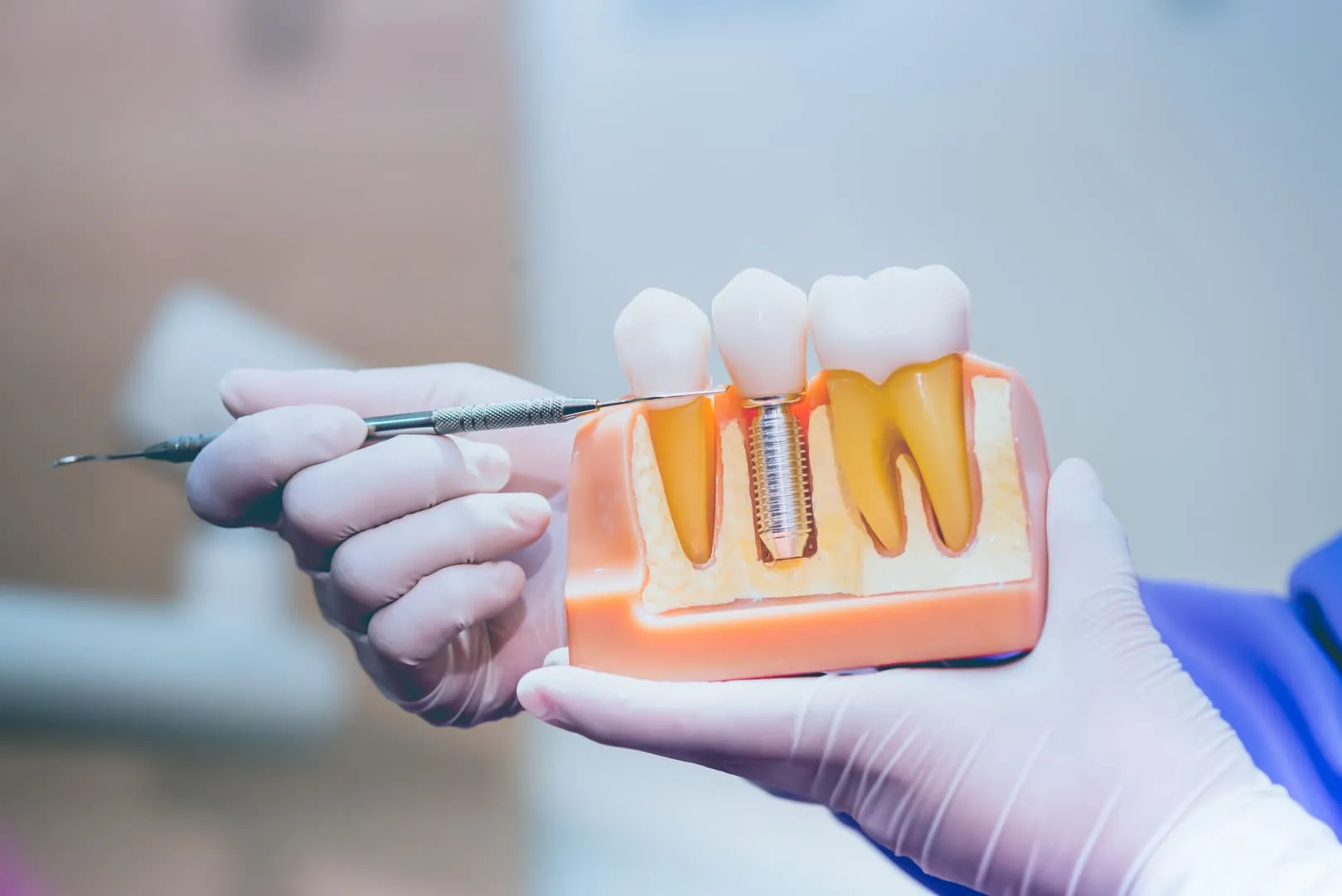 Odontología Restauradora